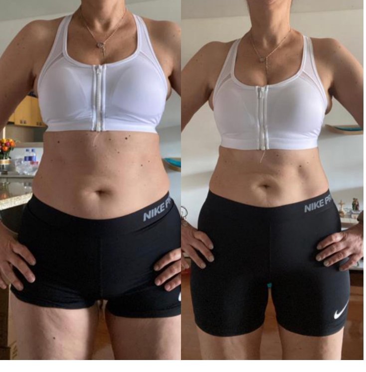 Comparativa frontal del abdomen antes y después de practicar hipopresivos